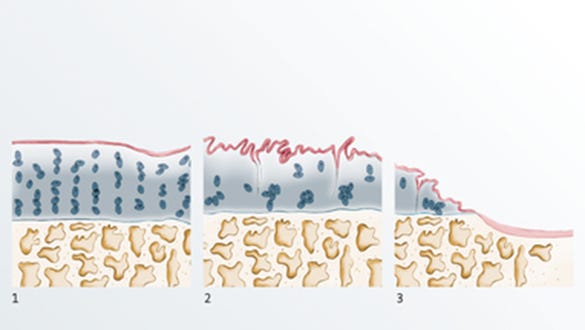 Causes of joint pain