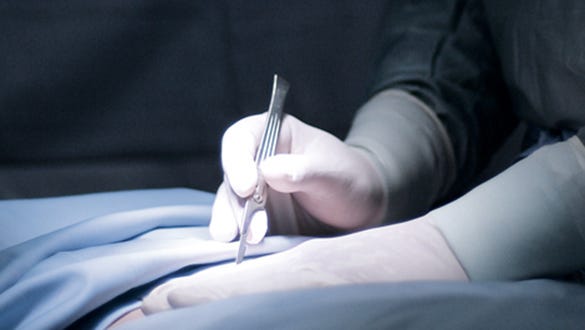 Picture of a doctor  performing cosmetic surgery on a patient in the operating room