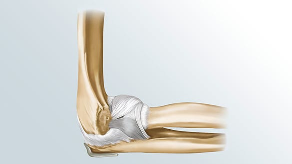 The image depicts an anatomical  illustration of an elbow joint with visible ligaments and bones.