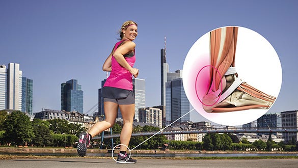 Picture showcasing symptoms of  a rupture of the Achilles tendon 