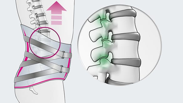 Facet joints – the joints between the vertebrae