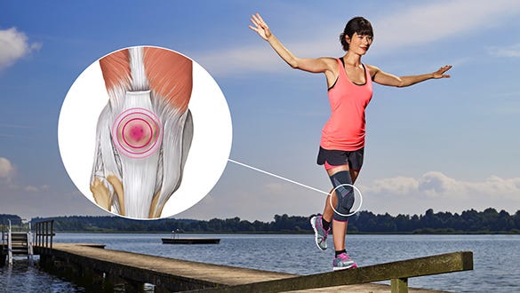 Patellofemoral pain syndrome