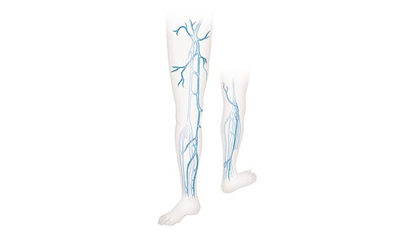 Detailed graphic image of the leg vein paths and their branches